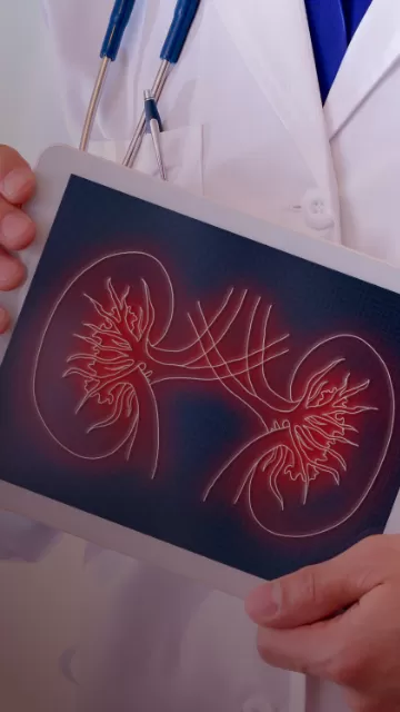 ¿Qué es el cáncer renal? 